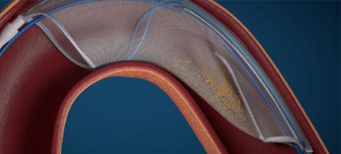 AorticLab 